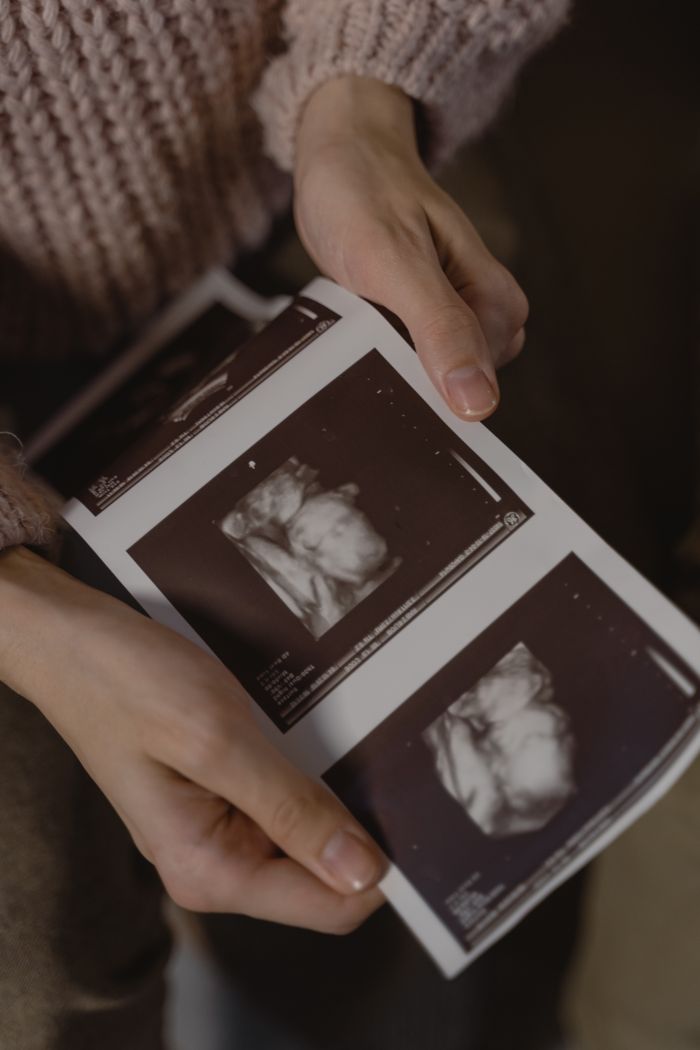 Hands gently holding ultrasound images, depicting a pregnancy moment.